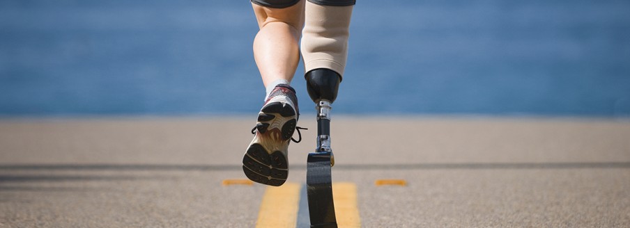 Is it time to replace your prosthetic?